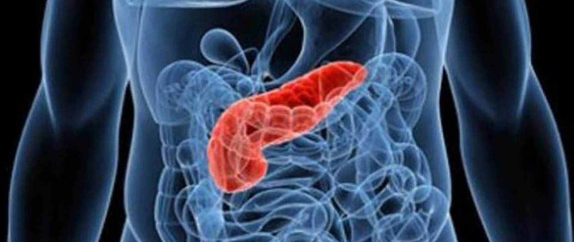 Tumore pancreatico, la ricerca avanza